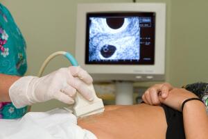 Опасна ли внематочная беременность и каковы ее причины?