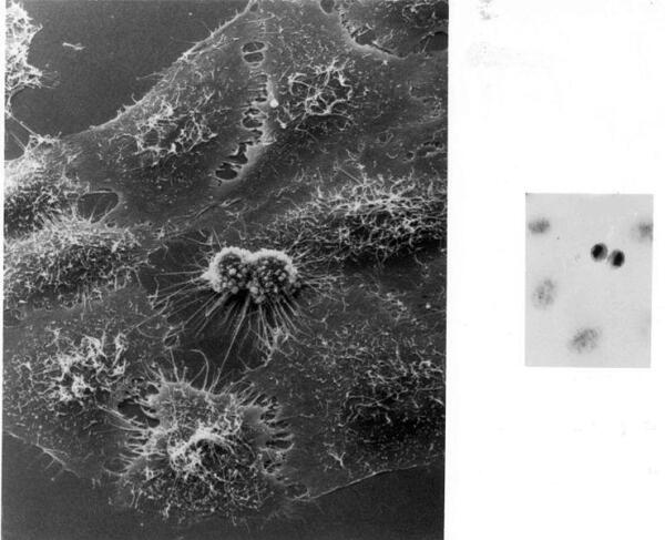 Деление клеток HeLa под электронным микроскопом