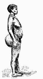 Готтентотская женщина со стеатопигией.