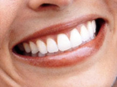 Как можно отбелить зубы?