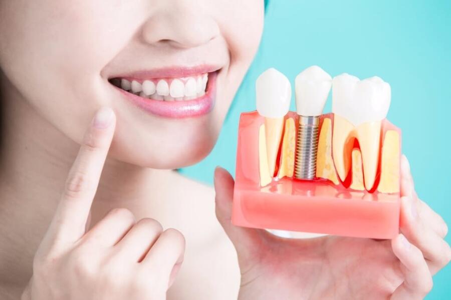 Имплантация зубов: важные особенности операции и её последствия