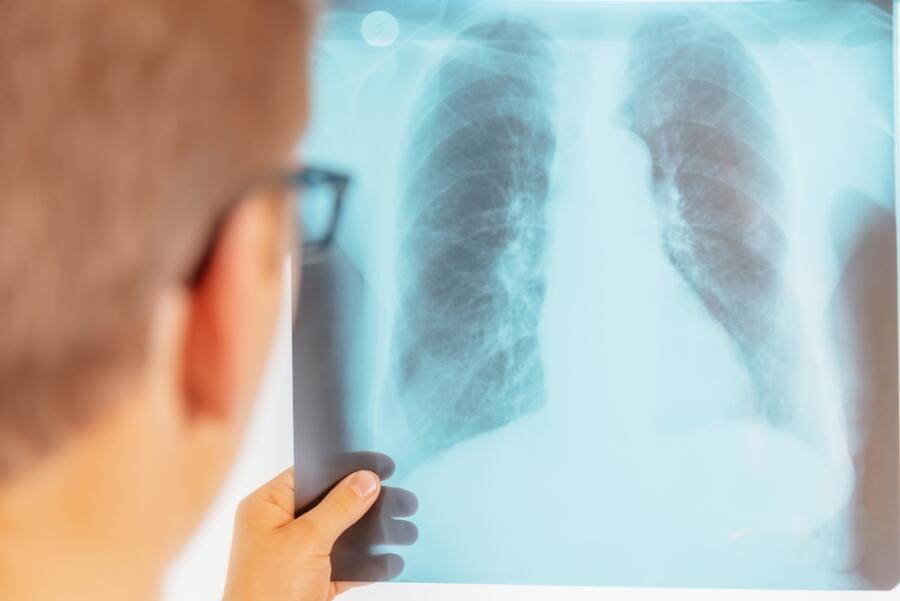 Как провести диагностику на туберкулез?
