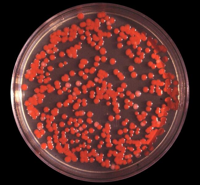 Serratia marcescens