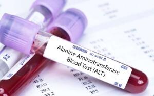 Повышены АЛТ и АСТ в анализе крови: что это значит и серьезно ли это?