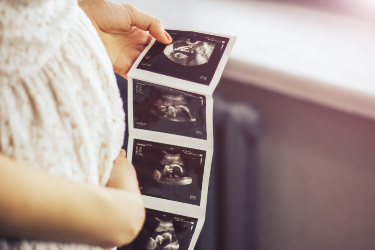 Трехмерное УЗИ при беременности. В чем его плюсы и минусы?