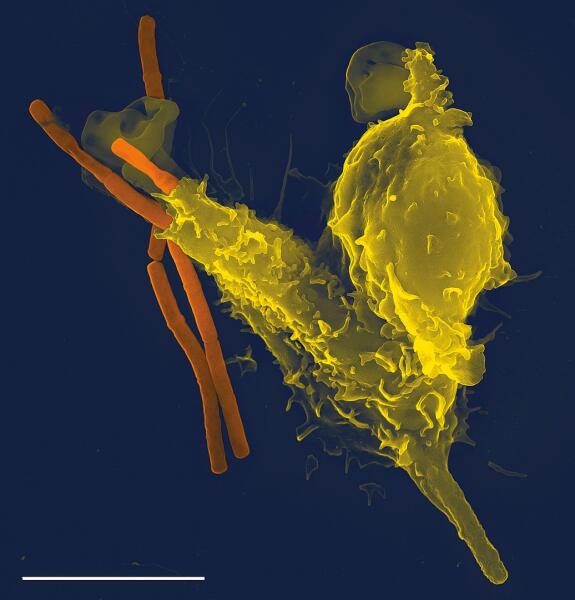 Микрофотография нейтрофила, фагоцитирующего клетки Bacillus anthracis (оранжевая). Сканирующая электронная микроскопия