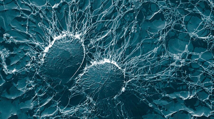 Клетки бактерии Staphylococcus aureus: крупные, волокнистые капсулы, защищающие от атаки фагоцитов