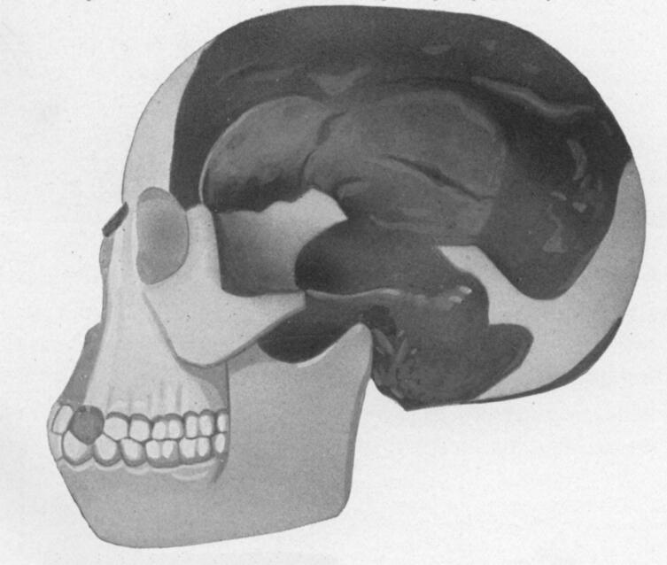 Реконструкция черепа «пилтдаунского человека» в исполнении Артура Вудворда
