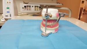 Лучшие и удобные съемные зубные протезы в стоматологии
