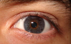 Блефаропластика: как вернуть молодость и красоту глаз